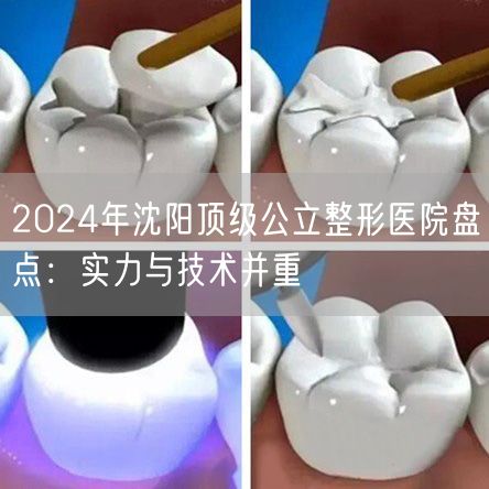 2024年沈阳顶级公立整形医院盘点：实力与技术并重
