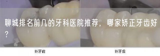 聊城排名前几的牙科医院推荐，哪家矫正牙齿好？