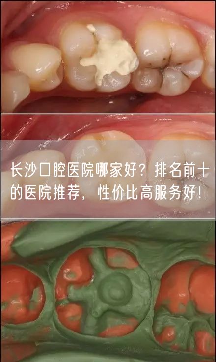 长沙口腔医院哪家好？排名前十的医院推荐，性价比高服务好！