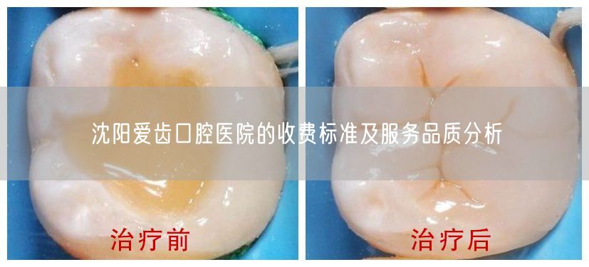 沈阳爱齿口腔医院的收费标准及服务品质分析