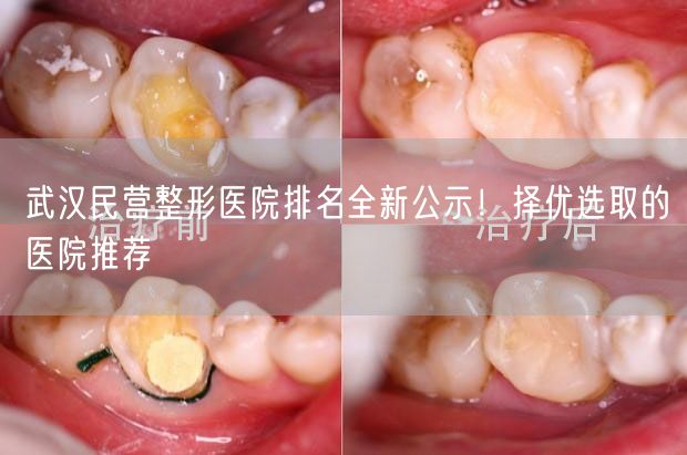 武汉民营整形医院排名全新公示！择优选取的医院推荐