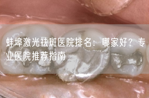 蚌埠激光祛斑医院排名：哪家好？专业医院推荐指南