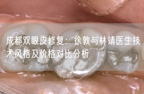 成都双眼皮修复：徐敦与林靖医生技术风格及价格对比分析