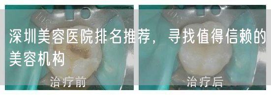 深圳美容医院排名推荐，寻找值得信赖的美容机构