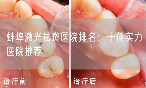 蚌埠激光祛斑医院排名：十佳实力医院推荐