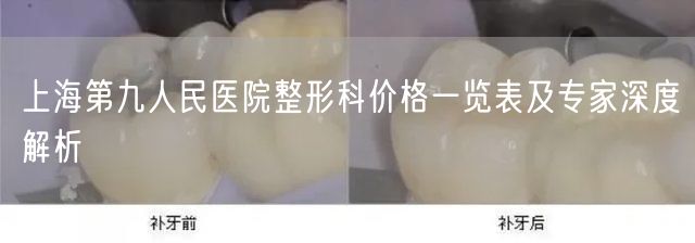 上海第九人民医院整形科价格一览表及专家深度解析