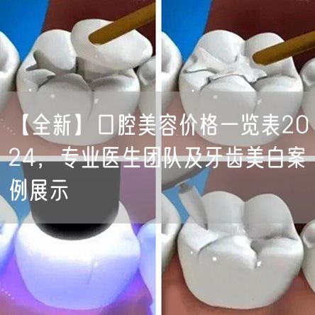 【全新】口腔美容价格一览表2024，专业医生团队及牙齿美白案例展示