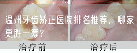 温州牙齿矫正医院排名推荐，哪家更胜一筹？