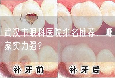 武汉市眼科医院排名推荐，哪家实力强？