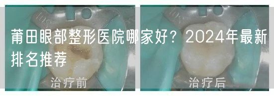 莆田眼部整形医院哪家好？2024年最新排名推荐