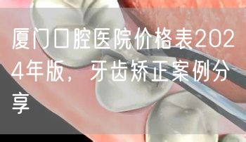 厦门口腔医院价格表2024年版，牙齿矫正案例分享