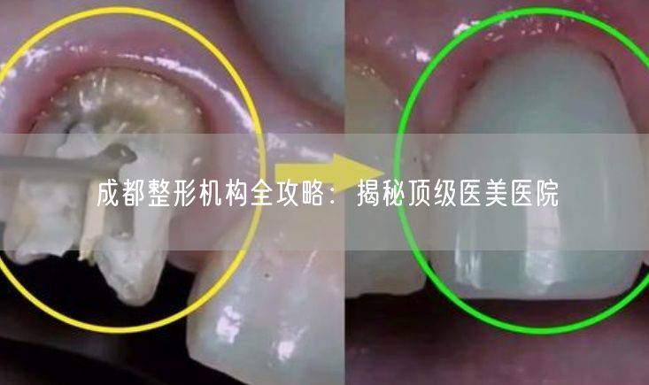 成都整形机构全攻略：揭秘顶级医美医院