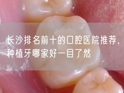 长沙排名前十的口腔医院推荐，种植牙哪家好一目了然