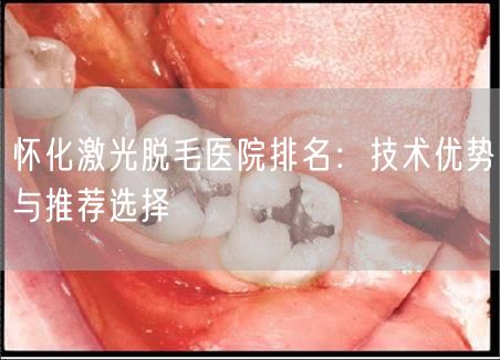怀化激光脱毛医院排名：技术优势与推荐选择