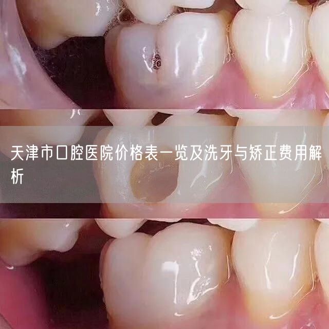 天津市口腔医院价格表一览及洗牙与矫正费用解析