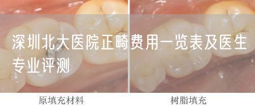 深圳北大医院正畸费用一览表及医生专业评测