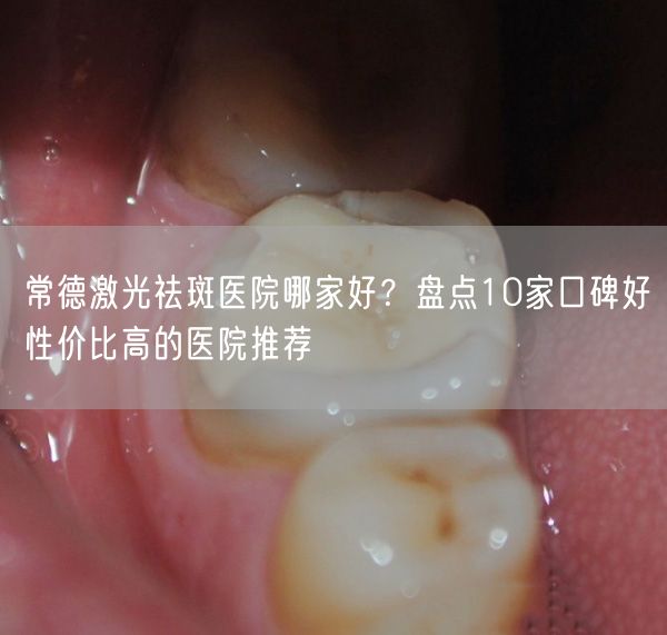 常德激光祛斑医院哪家好？盘点10家口碑好性价比高的医院推荐