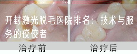 开封激光脱毛医院排名：技术与服务的佼佼者
