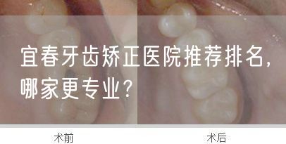 宜春牙齿矫正医院推荐排名，哪家更专业？