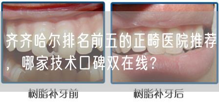 齐齐哈尔排名前五的正畸医院推荐，哪家技术口碑双在线？