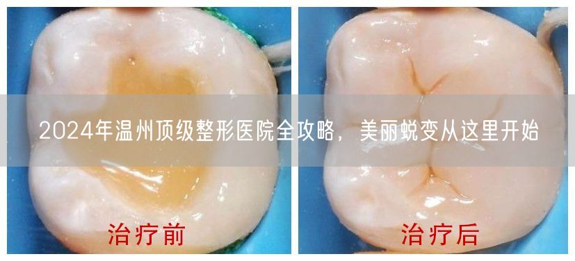 2024年温州顶级整形医院全攻略，美丽蜕变从这里开始
