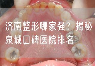 济南整形哪家强？揭秘泉城口碑医院排名