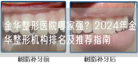 金华整形医院哪家强？2024年金华整形机构排名及推荐指南