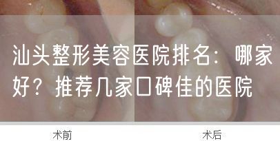 汕头整形美容医院排名：哪家好？推荐几家口碑佳的医院