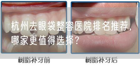 杭州去眼袋整容医院排名推荐，哪家更值得选择？