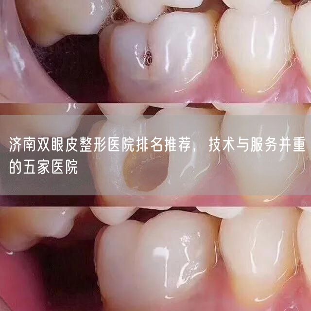 济南双眼皮整形医院排名推荐，技术与服务并重的五家医院