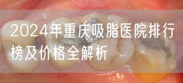 2024年重庆吸脂医院排行榜及价格全解析