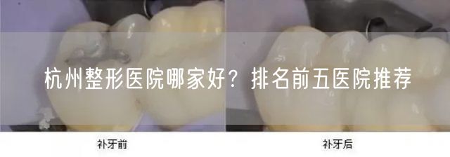 杭州整形医院哪家好？排名前五医院推荐