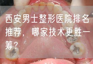 西安男士整形医院排名推荐，哪家技术更胜一筹？