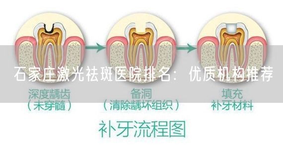 石家庄激光祛斑医院排名：优质机构推荐