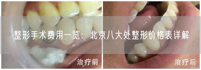 整形手术费用一览：北京八大处整形价格表详解