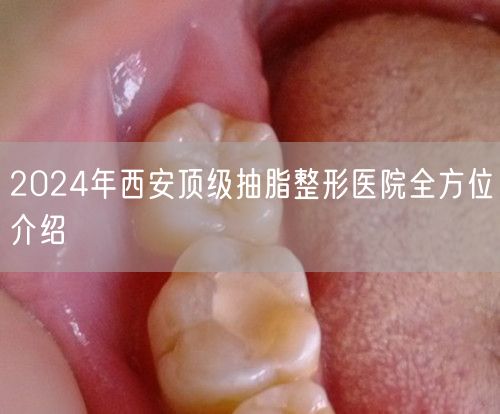 2024年西安顶级抽脂整形医院全方位介绍