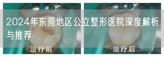 2024年东莞地区公立整形医院深度解析与推荐