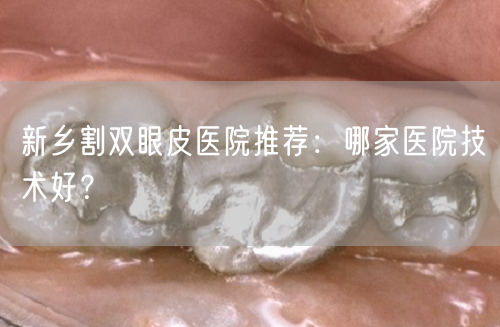 新乡割双眼皮医院推荐：哪家医院技术好？