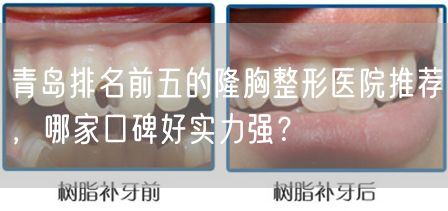 青岛排名前五的隆胸整形医院推荐，哪家口碑好实力强？