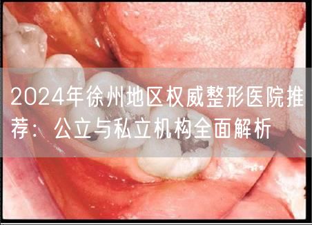 2024年徐州地区权威整形医院推荐：公立与私立机构全面解析