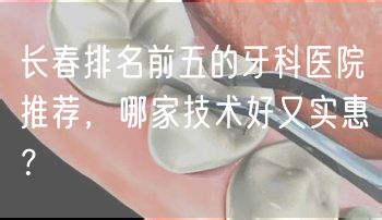 长春排名前五的牙科医院推荐，哪家技术好又实惠？