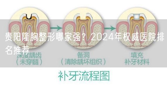 贵阳隆胸整形哪家强？2024年权威医院排名推荐