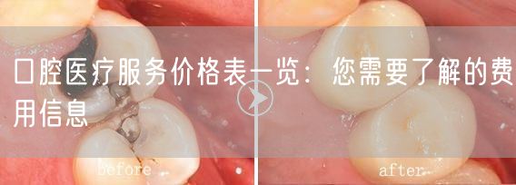 口腔医疗服务价格表一览：您需要了解的费用信息