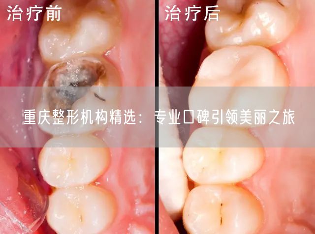 重庆整形机构精选：专业口碑引领美丽之旅