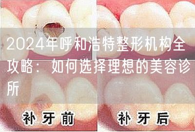 2024年呼和浩特整形机构全攻略：如何选择理想的美容诊所