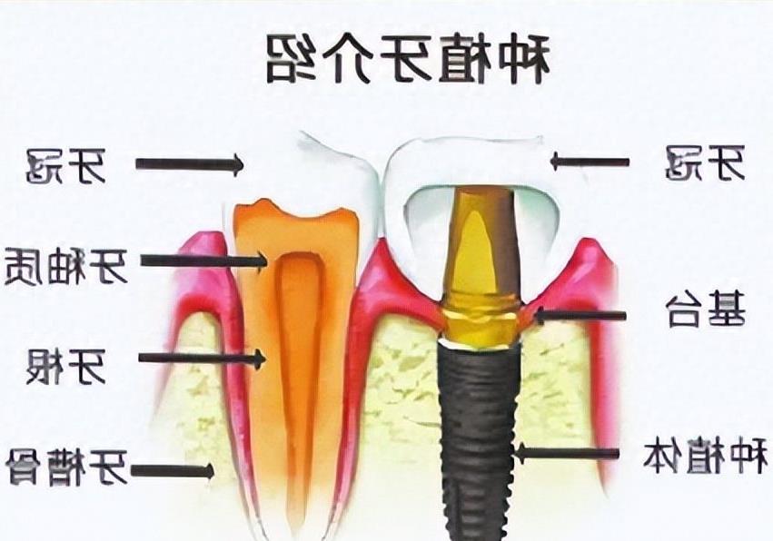北京儿童口腔医院简介：儿童的口腔健康问题同样重要，快来了解一下吧！(图3)