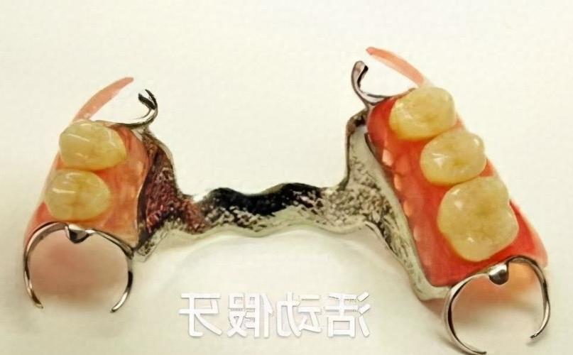 在成都，哪里能找到性价比高的种植牙呢？面对众多的种植牙品牌，我们该如何进行选择呢？(图2)