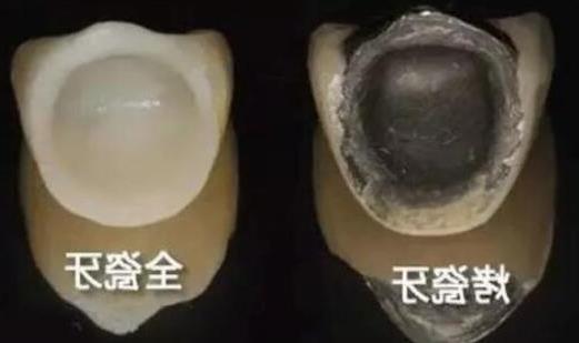 2024年楚雄奥德口腔医院：私立却专业，值得信赖的口腔医疗服务(图2)