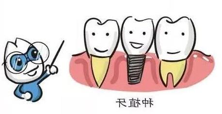 2024年国产自锁托槽品牌深度解析及特性对比(图1)