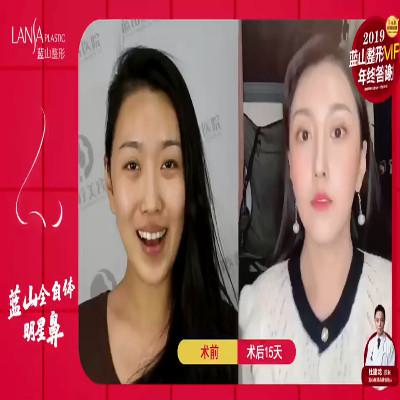 石家庄吸脂手术医院排名，哪家做得好？(图3)